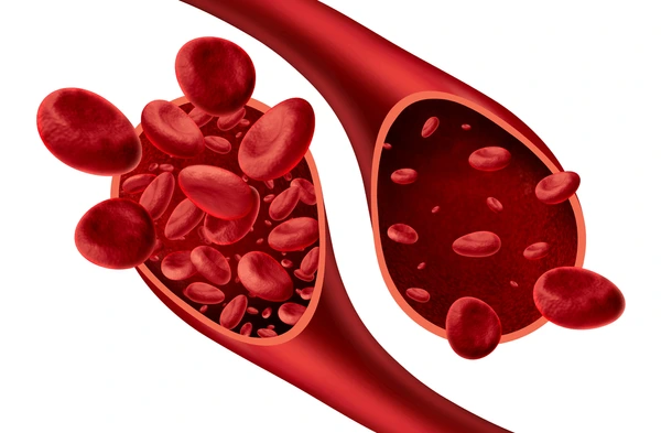 ANEMIA ANEMIA