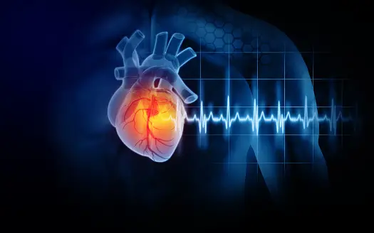 ECG ECG